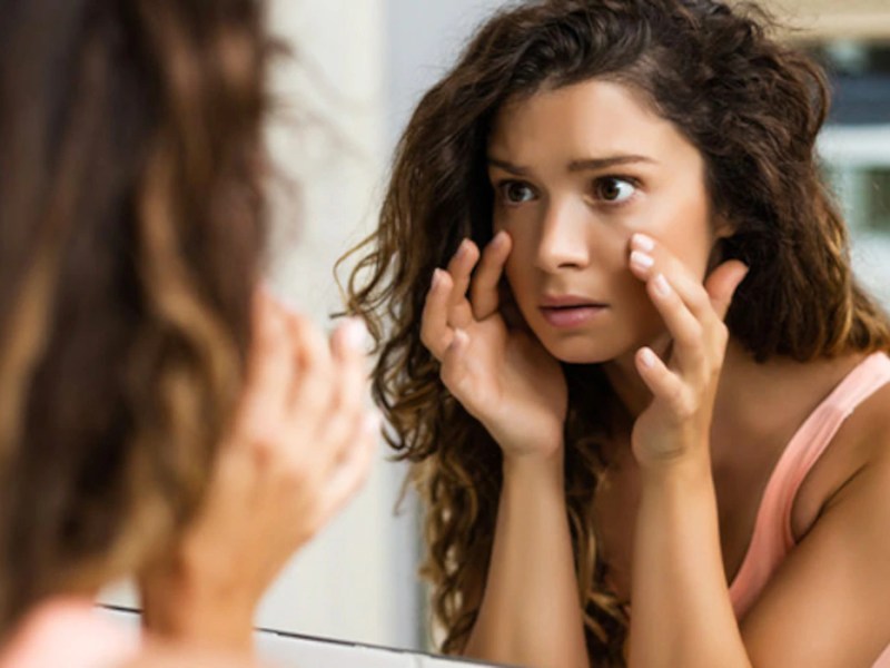 5 Ways To Reduce Wrinkles&nbsp;Naturally